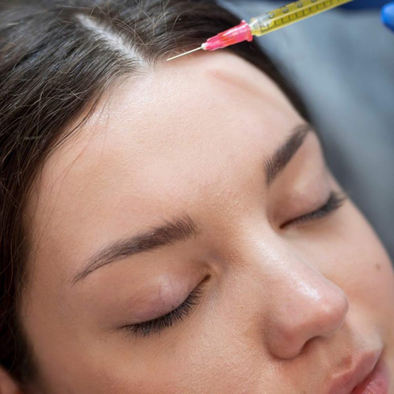 hair-Mesotherapy-injection-services