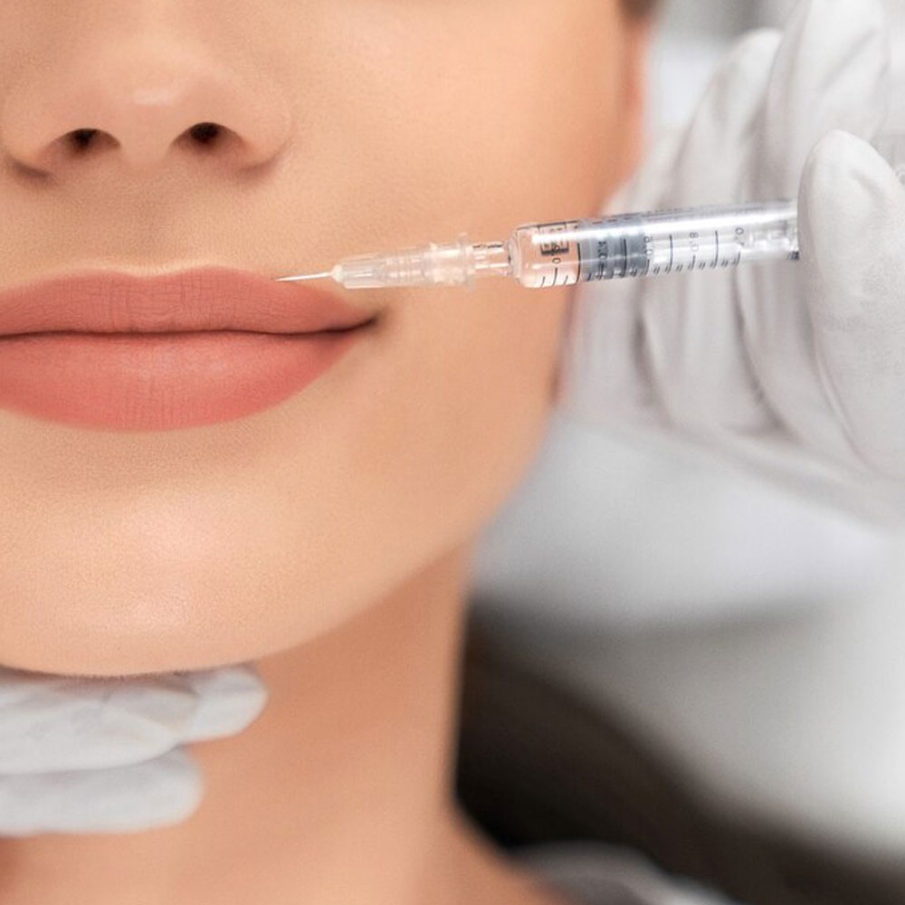 lip-filler-injection-services